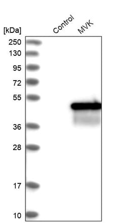 Invitrogen MVK Polyclonal Antibody 100 &mu;L | Buy Online | Invitrogen&trade; | Fisher Scientific