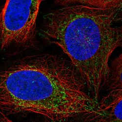 Invitrogen VASN Polyclonal Antibody 100 μL; Unconjugated:Antibodies,