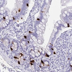 Invitrogen Chromogranin A Polyclonal Antibody 100 μL; Unconjugated:Antibodies,
