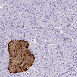 Invitrogen Chromogranin A Polyclonal Antibody 100 μL; Unconjugated:Antibodies,