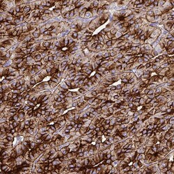 Invitrogen Chromogranin A Polyclonal Antibody 100 μL; Unconjugated:Antibodies,