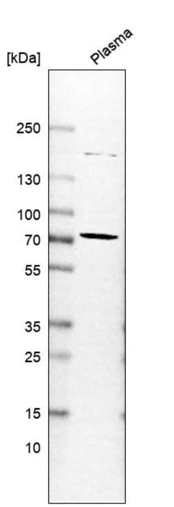 Invitrogen Chromogranin A Polyclonal Antibody 100 &mu;L; Unconjugated:Antikörper
