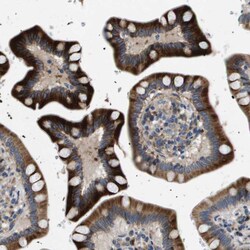 Invitrogen ENTPD2 Polyclonal Antibody 100 &mu;L; Unconjugated:Antibodies,