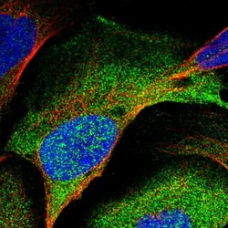 Invitrogen PSMC5 Polyclonal Antibody 100 &mu;L; Unconjugated:Antibodies,