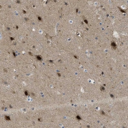 Invitrogen PSMC5 Polyclonal Antibody 100 &mu;L; Unconjugated:Antibodies,