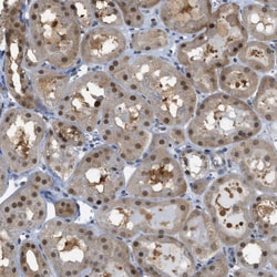 Invitrogen PSMC5 Polyclonal Antibody 100 &mu;L; Unconjugated:Antibodies,