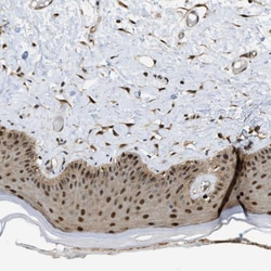 Invitrogen PSMC5 Polyclonal Antibody 100 &mu;L; Unconjugated:Antibodies,