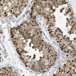 Invitrogen PSMC5 Polyclonal Antibody 100 &mu;L; Unconjugated:Antibodies,