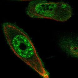 Invitrogen DRAK1 Polyclonal Antibody 100 &mu;L; Unconjugated:Antibodies,