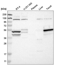 Invitrogen DRAK1 Polyclonal Antibody 100 &mu;L | Buy Online | Invitrogen&trade; | Fisher Scientific