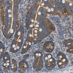 Invitrogen EMAP II Polyclonal Antibody 100 &mu;L | Buy Online | Invitrogen&trade; | Fisher Scientific