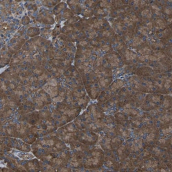 Invitrogen EMAP II Polyclonal Antibody 100 &mu;L | Buy Online | Invitrogen&trade; | Fisher Scientific