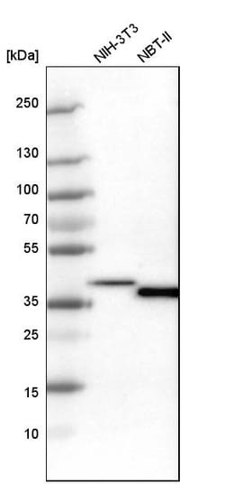 Invitrogen EMAP II Polyclonal Antibody 100 &mu;L | Buy Online | Invitrogen&trade; | Fisher Scientific