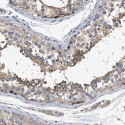 Invitrogen LGP2 Polyclonal Antibody 100 &mu;L; Unconjugated:Antibodies,