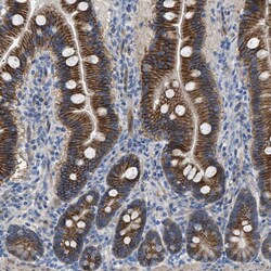 Invitrogen LGP2 Polyclonal Antibody 100 &mu;L; Unconjugated:Antibodies,