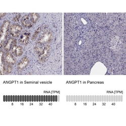 Invitrogen Angiopoietin 1 Polyclonal Antibody:Antibodies:Primary Antibodies