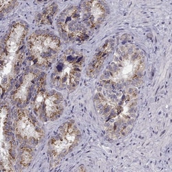 Invitrogen Angiopoietin 1 Polyclonal Antibody:Antibodies:Primary Antibodies