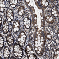 Invitrogen Angiopoietin 1 Polyclonal Antibody:Antibodies, Polyclonal