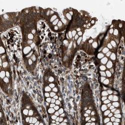Invitrogen BAG4 Polyclonal Antibody 100 &mu;L; Unconjugated:Antibodies,