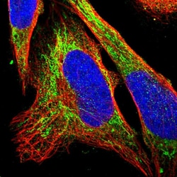 Invitrogen eIF4E2 Polyclonal Antibody 100 &mu;L; Unconjugated:Antibodies,