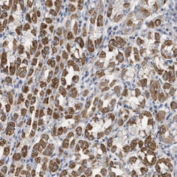 Invitrogen LGP2 Polyclonal Antibody:Antibodies:Primary Antibodies