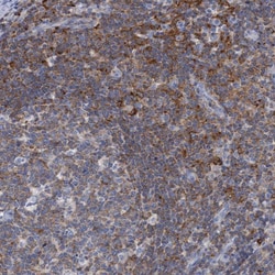 Invitrogen FNBP1 Polyclonal Antibody 100 &mu;L; Unconjugated:Antibodies,