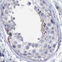 Invitrogen FNBP1 Polyclonal Antibody 100 &mu;L; Unconjugated:Antibodies,