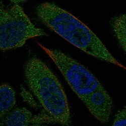 Invitrogen Biliverdin Reductase Polyclonal Antibody 100 &mu;L; Unconjugated:Antibodies,