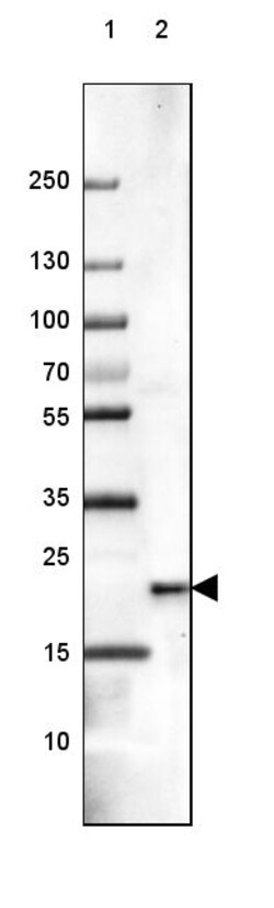 Invitrogen NCS1 Polyclonal Antibody 100 &mu;L | Buy Online | Invitrogen&trade; | Fisher Scientific