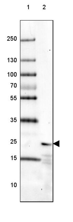 Invitrogen NCS1 Polyclonal Antibody 100 &mu;L | Buy Online | Invitrogen&trade; | Fisher Scientific