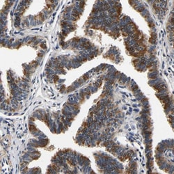 Invitrogen RUVBL1 Polyclonal Antibody 100 &mu;L; Unconjugated:Antibodies,