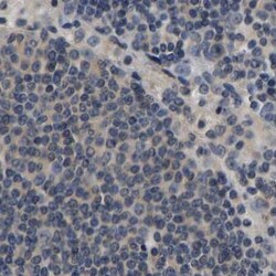 Invitrogen RUVBL1 Polyclonal Antibody 100 &mu;L; Unconjugated:Antibodies,