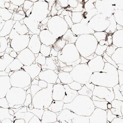 Invitrogen Complement C3 Polyclonal Antibody 100 &mu;L; Unconjugated:Antibodies,