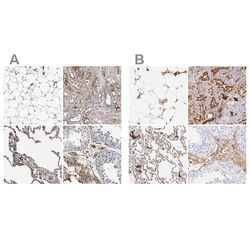Invitrogen Complement C3 Polyclonal Antibody 100 &mu;L; Unconjugated:Antibodies,