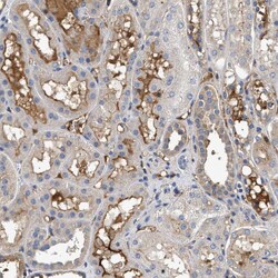 Invitrogen Complement C3 Polyclonal Antibody 100 &mu;L; Unconjugated:Antibodies,