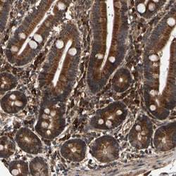 Invitrogen CIDEC Polyclonal Antibody:Antibodies:Primary Antibodies