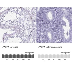 Invitrogen SCP1 Polyclonal Antibody 100 &mu;L; Unconjugated:Antibodies,
