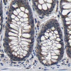Invitrogen RCAS1 Polyclonal Antibody 100 &mu;L; Unconjugated:Antibodies,