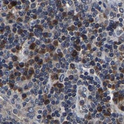 Invitrogen RCAS1 Polyclonal Antibody 100 &mu;L; Unconjugated:Antibodies,
