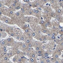 Invitrogen RCAS1 Polyclonal Antibody 100 &mu;L | Buy Online | Invitrogen&trade; | Fisher Scientific