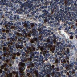 Invitrogen RCAS1 Polyclonal Antibody 100 &mu;L | Buy Online | Invitrogen&trade; | Fisher Scientific