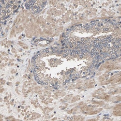 Invitrogen HTRA3 Polyclonal Antibody 100 μL; Unconjugated:Antibodies,
