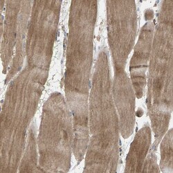 Invitrogen HTRA3 Polyclonal Antibody 100 μL; Unconjugated:Antibodies,