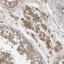 Invitrogen HTRA3 Polyclonal Antibody 100 μL; Unconjugated:Antibodies,
