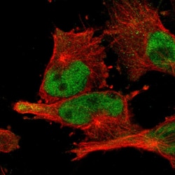 Invitrogen BRD9 Polyclonal Antibody 100 μL; Unconjugated:Antibodies,