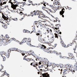 Invitrogen PPT1 Polyclonal Antibody 100 &mu;L; Unconjugated:Antibodies,