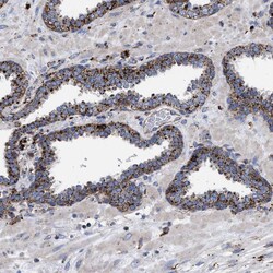 Invitrogen PPT1 Polyclonal Antibody 100 &mu;L; Unconjugated:Antibodies,