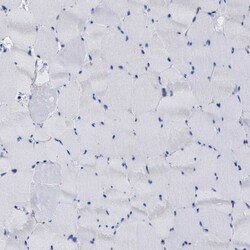 Invitrogen PPT1 Polyclonal Antibody 100 &mu;L; Unconjugated:Antibodies,