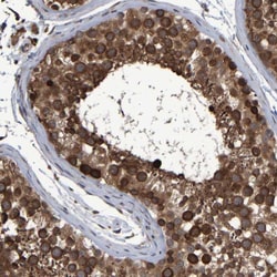 Invitrogen SPAG5 Polyclonal Antibody:Antibodies:Primary Antibodies