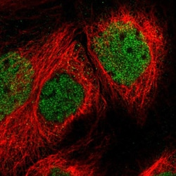 Invitrogen SPATA20 Polyclonal Antibody 100 &mu;L; Unconjugated:Antibodies,